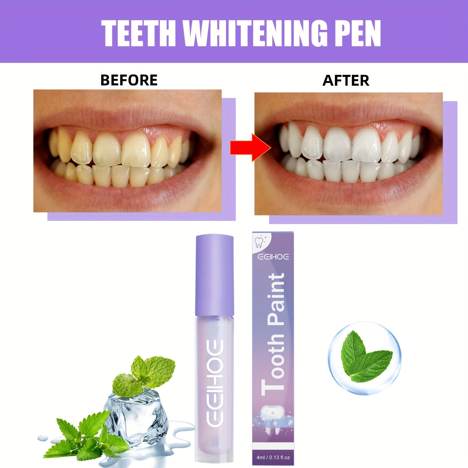 Before and after results using Brilliant Smile Tooth Whitening Pen.